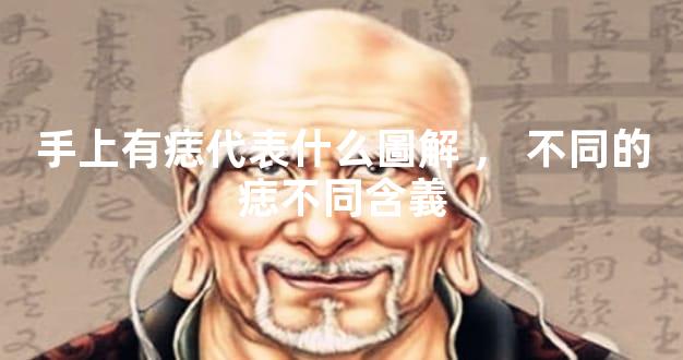 手上有痣代表什么圖解，不同的痣不同含義
